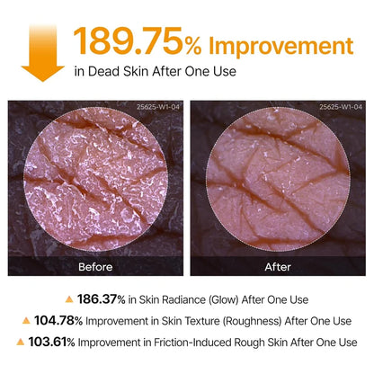 Dr.Melaxin Peel Shot Exfoliating Kojic Acid Turmeric Spray 200ml