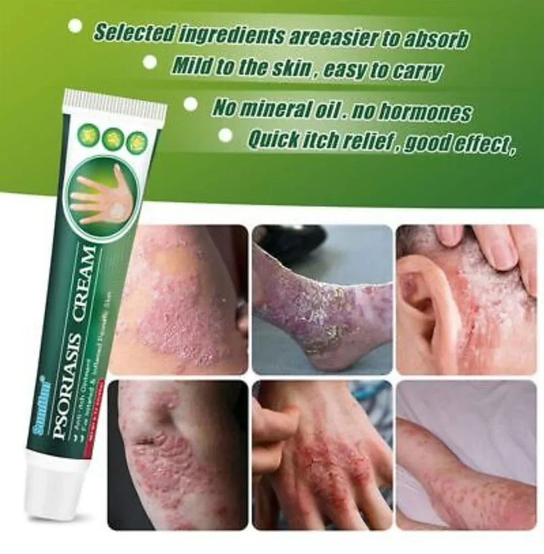 Psoriasis Cream (Original) – 20g